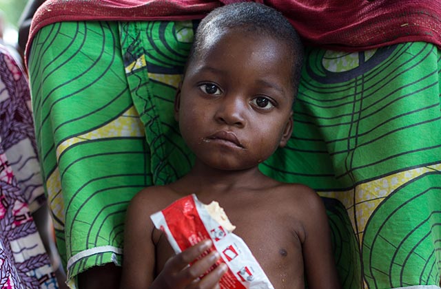 Aliments thérapeutiques : certains profitent du malheur des enfants pour s’enrichir