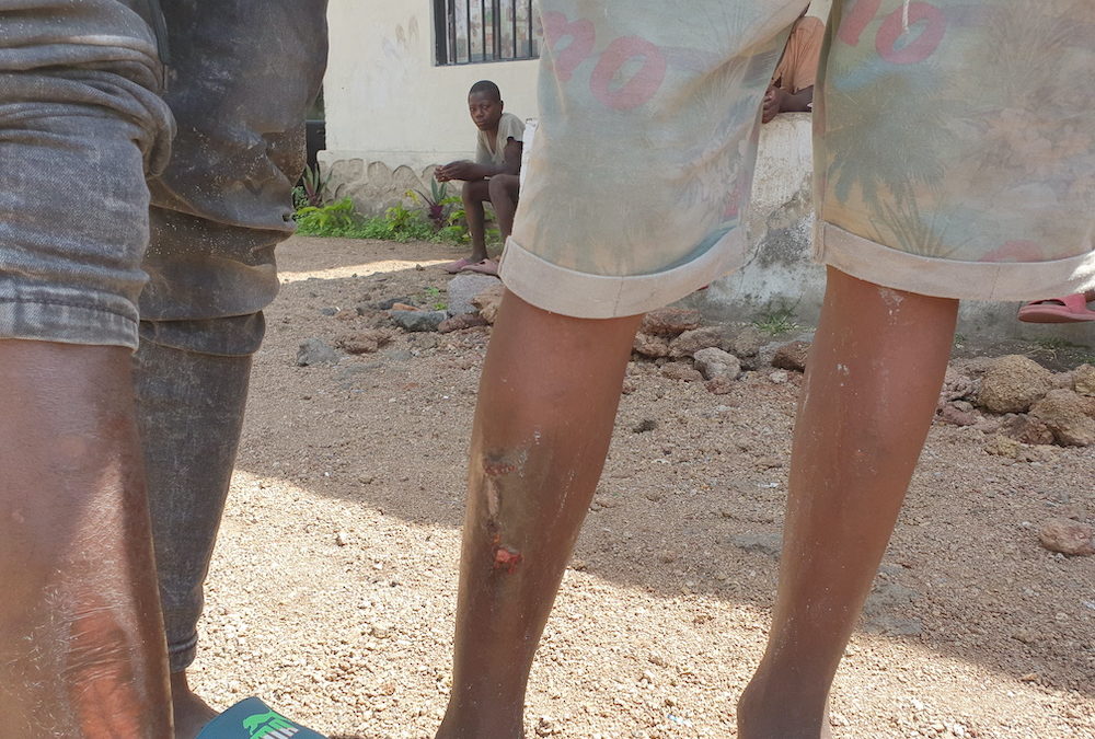 Enfants de la rue à Goma