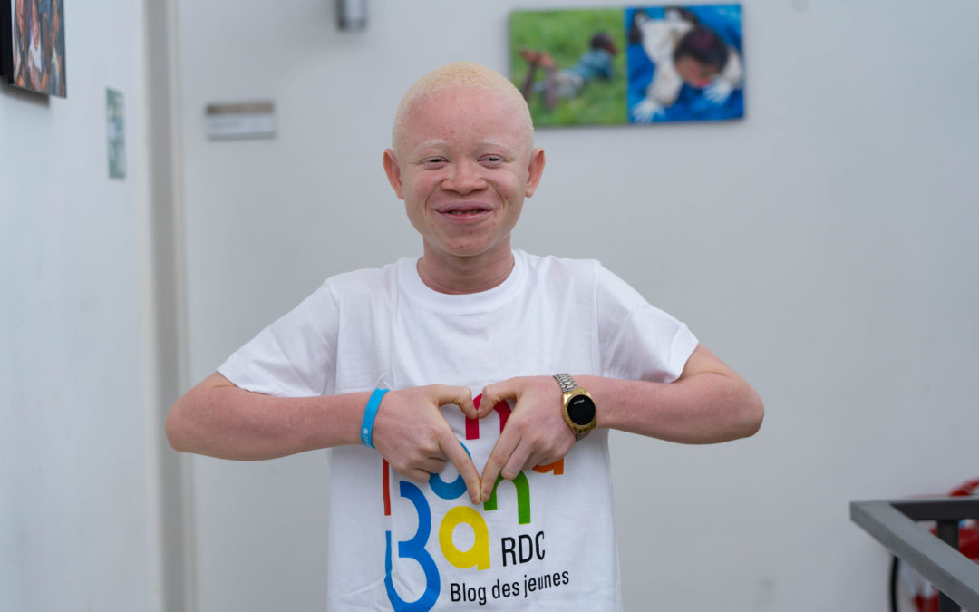 Atteint d’albinisme, Emmanuel Jidisa est ambassadeur de l’UNICEF