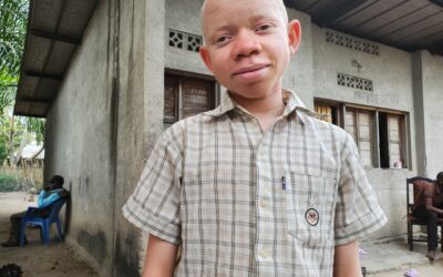 Albinos, je ne me sens en rien différent des autres
