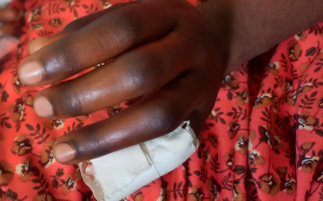 Kipushi : Elle verse de l’huile chaude sur sa nièce