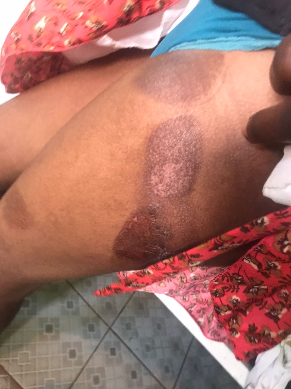 Maltraitance et violence sur enfant à Kipushi