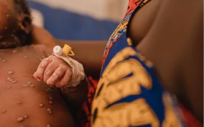 Ensemble protégeons les enfants de la mpox