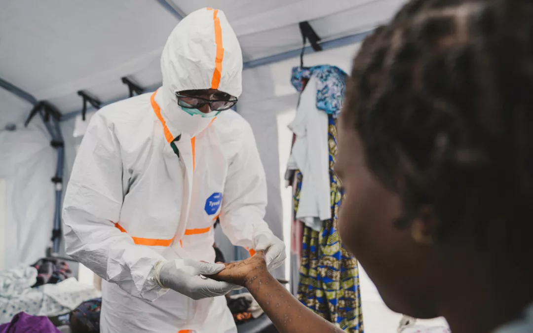 La sœur de mon amie a attrapé la mpox dans une fête